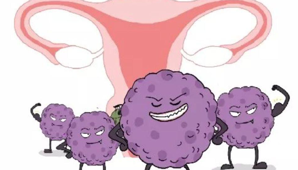 宫颈癌疫苗 该不该打