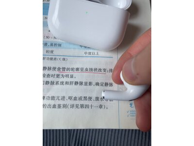 问一下vivotws3pro和oppo enco 2的区别很小么?说说选择哪个好些呀? 观点 第5张-本站 问一下vivotws3pro和oppo enco 2的区别很小么?说说选择哪个好些呀? 观点 第5张