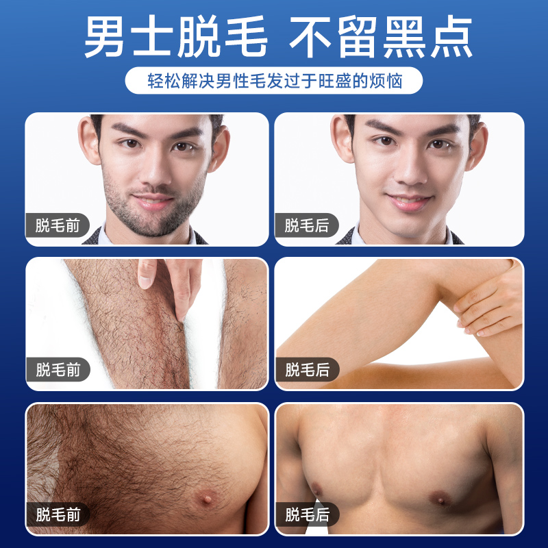 康佳脱毛仪男士专用全身冰肌点家用胡子脸部络腮胡长效持久去毛仪