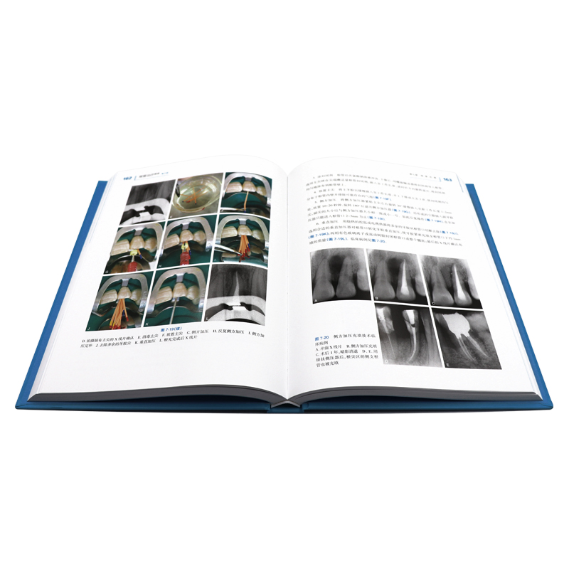 根管治疗图谱 第二版彭彬人卫牙科正畸种植基础知识失败的真实原因一步一步做好医学儿童修复牙周病学专业人民卫生出版社口腔书籍