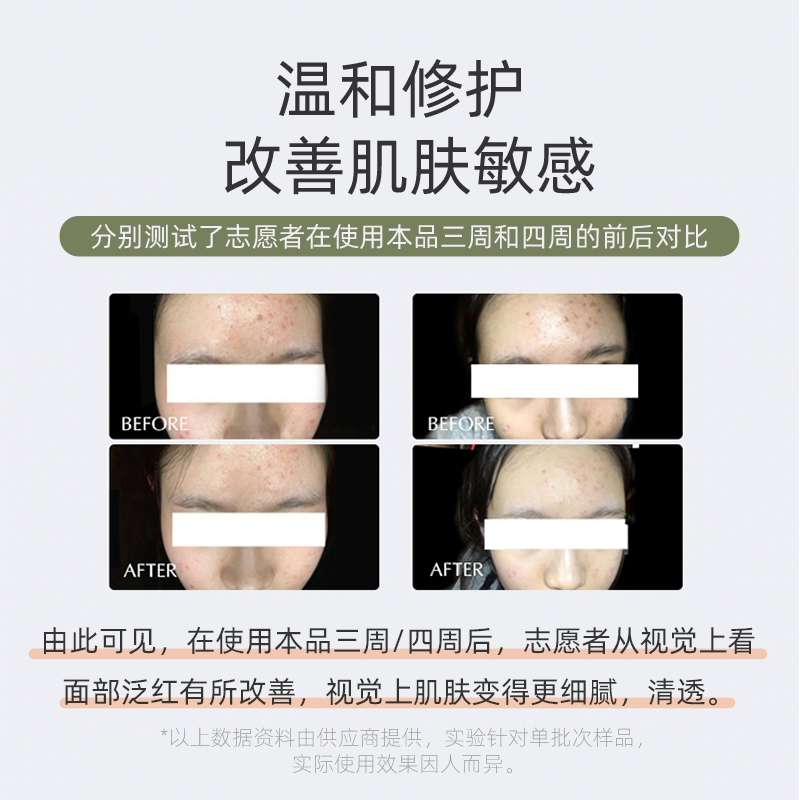 老爸评测雏菊的天空翡冷翠精华油面部舒缓修护精华护肤润泽工厂发