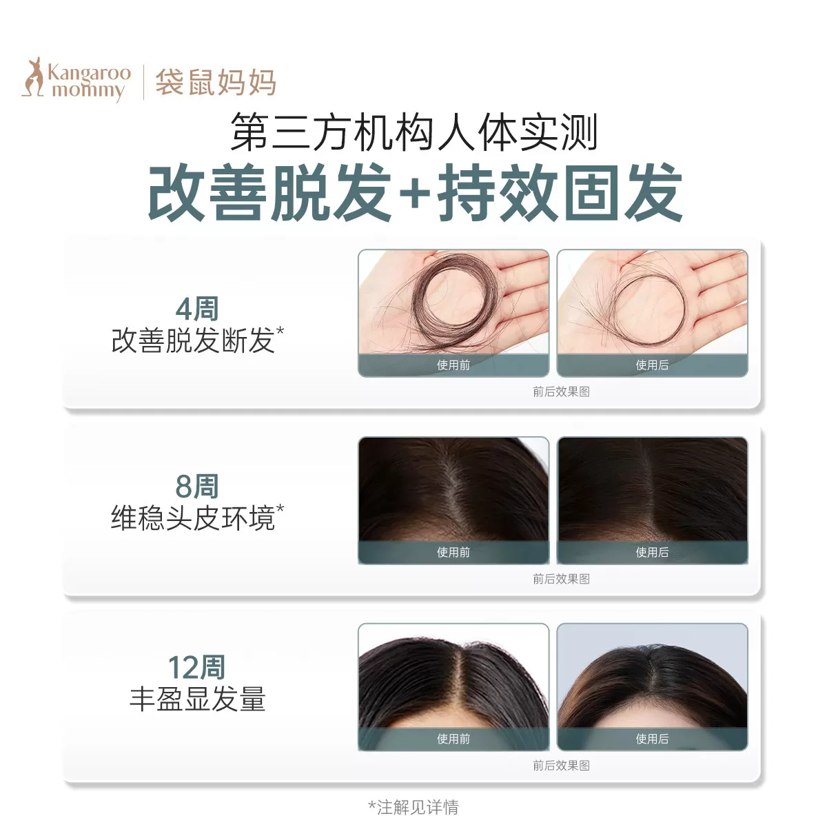 袋鼠妈妈防脱洗发水控油蓬松固发去屑专用洗护套装防脱洗发露