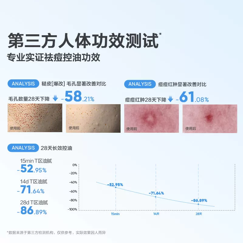 红色小象青少年控油祛痘乳青春期女孩男专用保湿乳液护肤品洁面