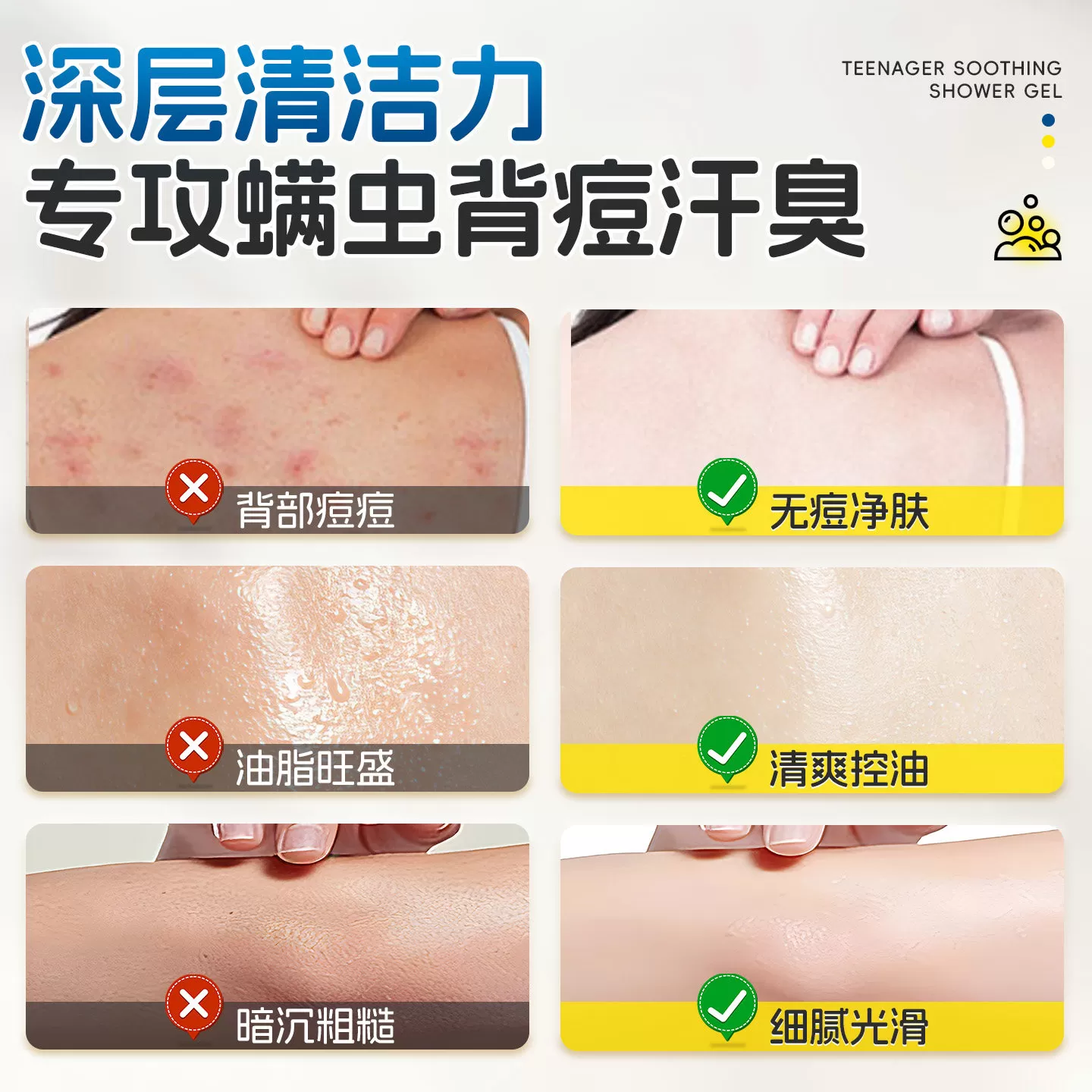 青少年沐浴露学生专用清洁后背祛痘除螨青春期专研沐浴乳男孩女孩