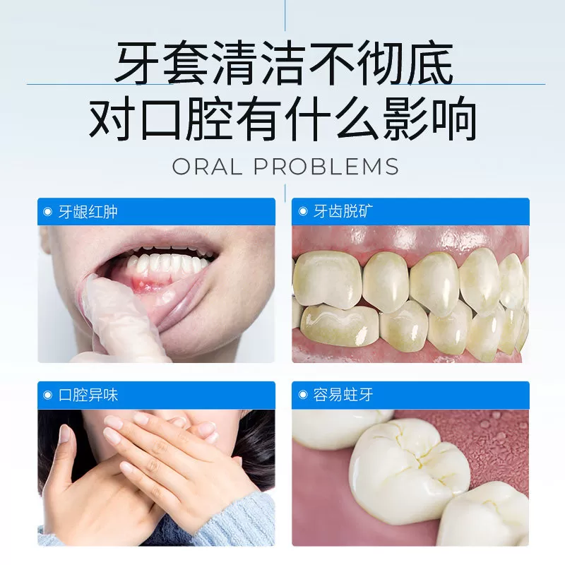 时代天使便携超声波清洗机隐形牙套保持器清洁矫正正畸神器假牙