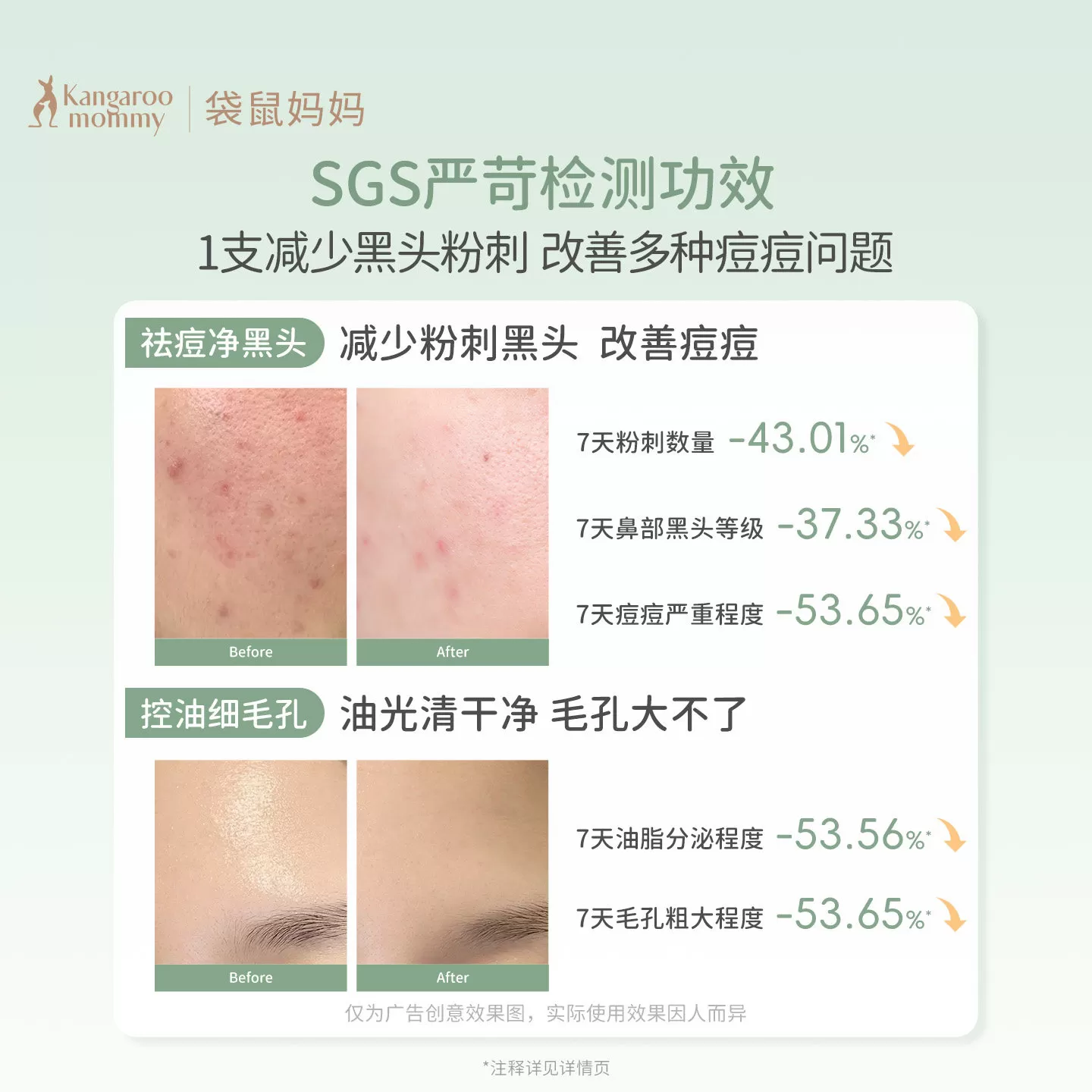 袋鼠妈妈青少年洁面乳控油祛痘男女孩青春期专用去黑头洗面奶30g